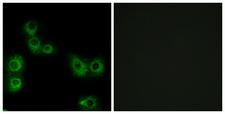 MRGPRX3 / MRGX3 Antibody - Immunofluorescence analysis of MCF7 cells, using MRGX3 Antibody. The picture on the right is blocked with the synthesized peptide.