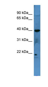 MRGPRX3 / MRGX3 Antibody - MRGPRX3 / MRGX3 antibody Western blot of COLO205 cell lysate.  This image was taken for the unconjugated form of this product. Other forms have not been tested.
