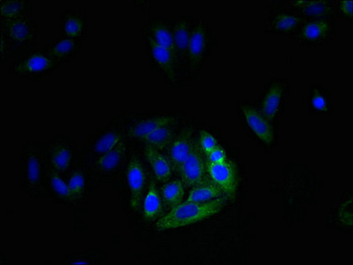 MRGPRX3 / MRGX3 Antibody - Immunofluorescent analysis of HepG2 cells using MRGPRX3 Antibody at dilution of 1:100 and Alexa Fluor 488-congugated AffiniPure Goat Anti-Rabbit IgG(H+L)
