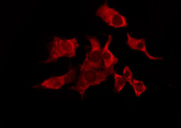 MRGPRX3 / MRGX3 Antibody - Staining HeLa cells by IF/ICC. The samples were fixed with PFA and permeabilized in 0.1% Triton X-100, then blocked in 10% serum for 45 min at 25°C. The primary antibody was diluted at 1:200 and incubated with the sample for 1 hour at 37°C. An Alexa Fluor 594 conjugated goat anti-rabbit IgG (H+L) Ab, diluted at 1/600, was used as the secondary antibody.