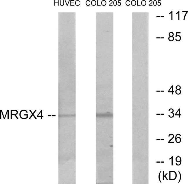 MRGPRX4 / MRGX4 Antibody - Western blot analysis of lysates from HUVEC and COLO cells, using MRGX4 Antibody. The lane on the right is blocked with the synthesized peptide.