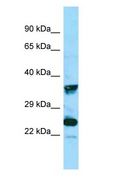 MRGPRX4 / MRGX4 Antibody - MRGPRX4 / MRGX4 antibody Western Blot of COLO205.  This image was taken for the unconjugated form of this product. Other forms have not been tested.