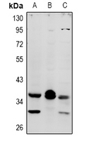 MRGPRX4 / MRGX4 Antibody - Western blot analysis of MRGX4 expression in U87MG (A), C6 (B), MCF7 (C) whole cell lysates.