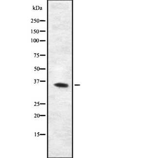 MRGPRX4 / MRGX4 Antibody - Western blot analysis of MRGX4 using K562 whole cells lysates