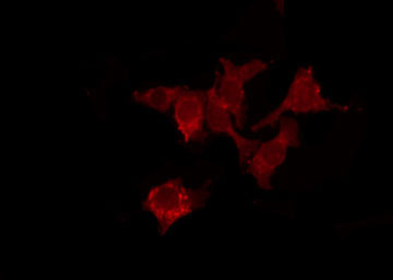 MRGPRX4 / MRGX4 Antibody - Staining HuvEc cells by IF/ICC. The samples were fixed with PFA and permeabilized in 0.1% Triton X-100, then blocked in 10% serum for 45 min at 25°C. The primary antibody was diluted at 1:200 and incubated with the sample for 1 hour at 37°C. An Alexa Fluor 594 conjugated goat anti-rabbit IgG (H+L) Ab, diluted at 1/600, was used as the secondary antibody.
