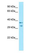 MRGX1 / MRGPRX1 Antibody - MRGX1 / MRGPRX1 antibody Western Blot of Fetal Small Intestine.  This image was taken for the unconjugated form of this product. Other forms have not been tested.