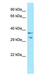 MRGX1 / MRGPRX1 Antibody - MRGX1 / MRGPRX1 antibody Western Blot of Fetal Small Intestine.  This image was taken for the unconjugated form of this product. Other forms have not been tested.