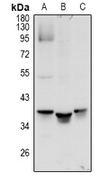 MRGX1 / MRGPRX1 Antibody - Western blot analysis of MRGX1 expression in U87MG (A) whole cell lysates.