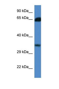 MRI1 Antibody - MRI1 antibody Western blot of Fetal Liver lysate. Antibody concentration 1 ug/ml.  This image was taken for the unconjugated form of this product. Other forms have not been tested.