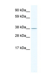 MRI1 Antibody - MGC3207 antibody ARP37364_T100-NP_080699-2410018C20RIK Antibody Western blot of NIH/3T3 cell lysate.  This image was taken for the unconjugated form of this product. Other forms have not been tested.