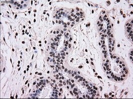 MRI1 Antibody - Immunohistochemical staining of paraffin-embedded breast tissue using anti-MRI1 mouse monoclonal antibody. (Dilution 1:50).