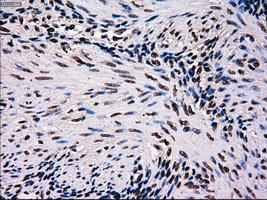 MRI1 Antibody - Immunohistochemical staining of paraffin-embedded endometrium tissue using anti-MRI1 mouse monoclonal antibody. (Dilution 1:50).