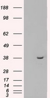 MRI1 Antibody - HEK293T cells were transfected with the pCMV6-ENTRY control (Left lane) or pCMV6-ENTRY MRI1 (Right lane) cDNA for 48 hrs and lysed. Equivalent amounts of cell lysates (5 ug per lane) were separated by SDS-PAGE and immunoblotted with anti-MRI1.