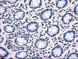 MRI1 Antibody - IHC of paraffin-embedded colon tissue using anti-MRI1 mouse monoclonal antibody. (Dilution 1:50).