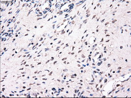 MRI1 Antibody - IHC of paraffin-embedded Ovary tissue using anti-MRI1 mouse monoclonal antibody. (Dilution 1:50).