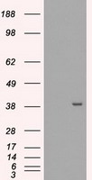 MRI1 Antibody - HEK293T cells were transfected with the pCMV6-ENTRY control (Left lane) or pCMV6-ENTRY MRI1 (Right lane) cDNA for 48 hrs and lysed. Equivalent amounts of cell lysates (5 ug per lane) were separated by SDS-PAGE and immunoblotted with anti-MRI1.