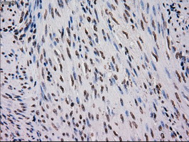 MRI1 Antibody - IHC of paraffin-embedded endometrium tissue using anti-MRI1 mouse monoclonal antibody. (Dilution 1:50).