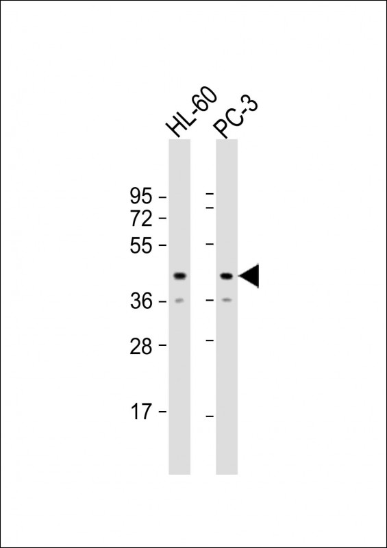 MRI1 Antibody - All lanes: Anti-MRI1 Antibody (Center) at 1:8000 dilution Lane 1: HL-60 whole cell lysate Lane 2: PC-3 whole cell lysate Lysates/proteins at 20 µg per lane. Secondary Goat Anti-Rabbit IgG, (H+L), Peroxidase conjugated at 1/10000 dilution. Predicted band size: 39 kDa Blocking/Dilution buffer: 5% NFDM/TBST.