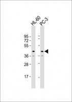 MRI1 Antibody - All lanes: Anti-MRI1 Antibody (Center) at 1:8000 dilution Lane 1: HL-60 whole cell lysate Lane 2: PC-3 whole cell lysate Lysates/proteins at 20 µg per lane. Secondary Goat Anti-Rabbit IgG, (H+L), Peroxidase conjugated at 1/10000 dilution. Predicted band size: 39 kDa Blocking/Dilution buffer: 5% NFDM/TBST.