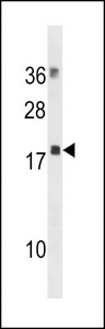 MRLC2 / MYL12B Antibody - MYL12B Antibody western blot of human placenta tissue lysates (35 ug/lane). The MYL12B antibody detected the MYL12B protein (arrow).