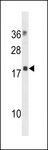 MRLC2 / MYL12B Antibody - MYL12B Antibody western blot of human placenta tissue lysates (35 ug/lane). The MYL12B antibody detected the MYL12B protein (arrow).