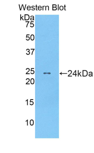 MRLC2 / MYL12B Antibody - Western blot of recombinant MRLC2 / MYL12B.  This image was taken for the unconjugated form of this product. Other forms have not been tested.