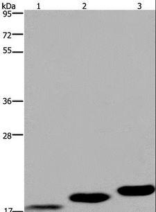 MRLC2 / MYL12B Antibody - Western blot analysis of Mouse skeletal muscle, heart and bladder tissue, using MYL12B Polyclonal Antibody at dilution of 1:450.