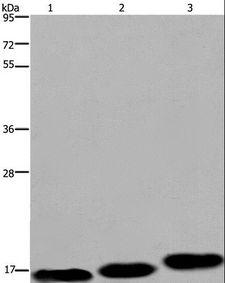 MRLC2 / MYL12B Antibody - Western blot analysis of Mouse skeletal muscle, heart and bladder tissue, using MYL12B Polyclonal Antibody at dilution of 1:550.
