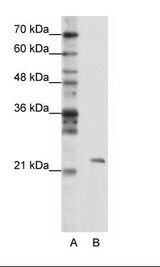 MRM1 Antibody - A: Marker, B: HepG2 Cell Lysate.  This image was taken for the unconjugated form of this product. Other forms have not been tested.