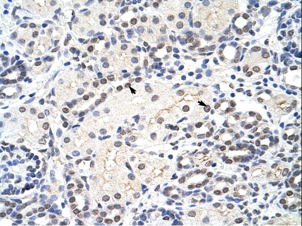 MRM1 Antibody - MRM1 antibody ARP41015_T100-AAH09416-MRM1 (mitochondrial rRNA methyltransferase 1 homolog (S. cerevisiae)) Antibody was used in IHC to stain formalin-fixed, paraffin-embedded human kidney.  This image was taken for the unconjugated form of this product. Other forms have not been tested.