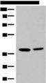 MRM1 Antibody - Western blot analysis of K562 and HEPG2 cell lysates  using MRM1 Polyclonal Antibody at dilution of 1:400