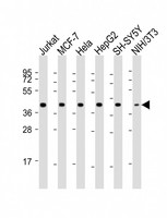 MRNP41 / RAE1 Antibody - All lanes: Anti-RAE1 Antibody (Center) at 1:2000 dilution. Lane 1: Jurkat whole cell lysate. Lane 2: MCF-7 whole cell lysate. Lane 3: HeLa whole cell lysate. Lane 4: HepG2 whole cell lysate. Lane 5: SH-SY5Y whole cell lysate. Lane 6: NIH/3T3 whole cell lysate Lysates/proteins at 20 ug per lane. Secondary Goat Anti-Rabbit IgG, (H+L), Peroxidase conjugated at 1:10000 dilution. Predicted band size: 41 kDa. Blocking/Dilution buffer: 5% NFDM/TBST.