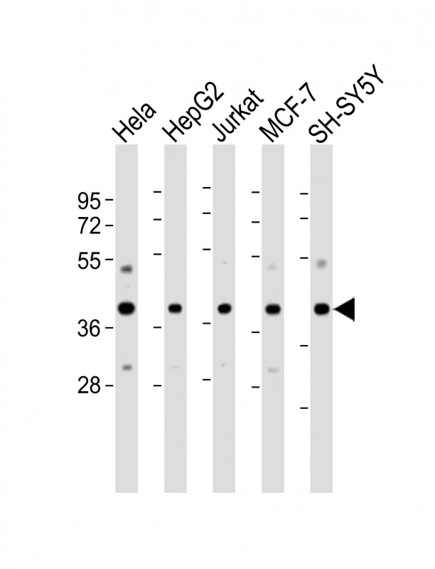 MRNP41 / RAE1 Antibody - All lanes: Anti-RAE1 Antibody (N-Term) at 1:2000-1:4000 dilution. Lane 1: HeLa whole cell lysate. Lane 2: HepG2 whole cell lysate. Lane 3: Jurkat whole cell lysate. Lane 4: MCF-7 whole cell lysate. Lane 5: SH-SY5Y whole cell lysate Lysates/proteins at 20 ug per lane. Secondary Goat Anti-Rabbit IgG, (H+L), Peroxidase conjugated at 1:10000 dilution. Predicted band size: 41 kDa. Blocking/Dilution buffer: 5% NFDM/TBST.