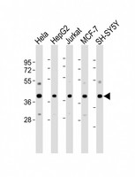 MRNP41 / RAE1 Antibody - All lanes: Anti-RAE1 Antibody (N-Term) at 1:2000-1:4000 dilution. Lane 1: HeLa whole cell lysate. Lane 2: HepG2 whole cell lysate. Lane 3: Jurkat whole cell lysate. Lane 4: MCF-7 whole cell lysate. Lane 5: SH-SY5Y whole cell lysate Lysates/proteins at 20 ug per lane. Secondary Goat Anti-Rabbit IgG, (H+L), Peroxidase conjugated at 1:10000 dilution. Predicted band size: 41 kDa. Blocking/Dilution buffer: 5% NFDM/TBST.