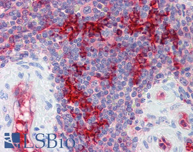 MRNP41 / RAE1 Antibody - Anti-RAE1 antibody IHC of human spleen. Immunohistochemistry of formalin-fixed, paraffin-embedded tissue after heat-induced antigen retrieval. Antibody concentration 5 ug/ml.  This image was taken for the unconjugated form of this product. Other forms have not been tested.
