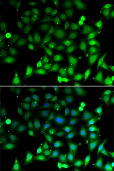 MRNP41 / RAE1 Antibody - Immunofluorescence analysis of MCF7 cells.