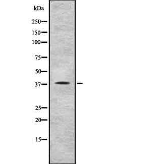 MRNP41 / RAE1 Antibody - Western blot analysis of RAE1 using COLO205 whole cells lysates