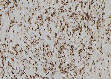 MRNP41 / RAE1 Antibody - 1:100 staining human gastric tissue by IHC-P. The sample was formaldehyde fixed and a heat mediated antigen retrieval step in citrate buffer was performed. The sample was then blocked and incubated with the antibody for 1.5 hours at 22°C. An HRP conjugated goat anti-rabbit antibody was used as the secondary.