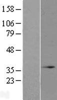 MRO Protein - Western validation with an anti-DDK antibody * L: Control HEK293 lysate R: Over-expression lysate