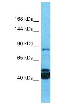 MROH1 / HEATR7A Antibody - MROH1 / HEATR7A antibody Western Blot of OVCAR-3. Antibody dilution: 1 ug/ml.  This image was taken for the unconjugated form of this product. Other forms have not been tested.