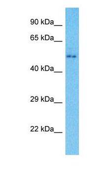 MROH8 Antibody - Western blot of MROH8 Antibody with human Ovary Tumor lysate.  This image was taken for the unconjugated form of this product. Other forms have not been tested.