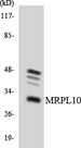MRPL10 Antibody - Western blot analysis of the lysates from HT-29 cells using MRPL10 antibody.
