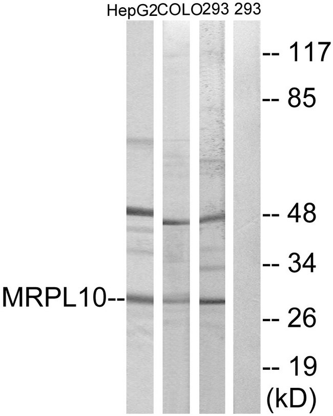 MRPL10 Antibody - Western blot analysis of lysates from 293, HepG2, and COLO cells, using MRPL10 Antibody. The lane on the right is blocked with the synthesized peptide.