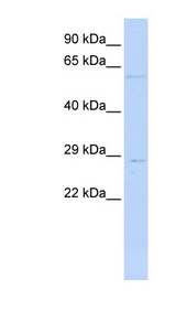 MRPL10 Antibody - MRPL10 antibody Western blot of Jurkat lysate. This image was taken for the unconjugated form of this product. Other forms have not been tested.