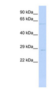 MRPL10 Antibody - MRPL10 antibody Western blot of Jurkat lysate. This image was taken for the unconjugated form of this product. Other forms have not been tested.