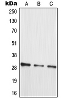 MRPL10 Antibody - Western blot analysis of MRPL10 expression in HT29 (A); Jurkat (B); HepG2 (C) whole cell lysates.