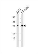 MRPL10 Antibody - All lanes : Anti-MRPL10 Antibody at 1:1000 dilution Lane 1: A431 whole cell lysates Lane 2: HT-1080 whole cell lysates Lysates/proteins at 20 ug per lane. Secondary Goat Anti-Rabbit IgG, (H+L),Peroxidase conjugated at 1/10000 dilution Predicted band size : 29 kDa Blocking/Dilution buffer: 5% NFDM/TBST.