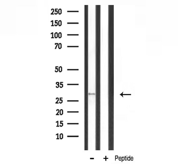 MRPL10 Antibody - Western blot analysis of MRPL10 expression in rat muscle lysate