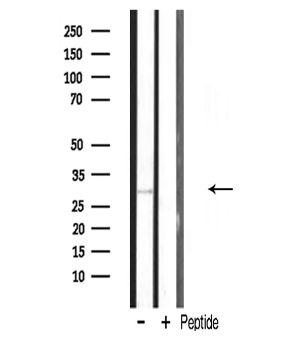 MRPL10 Antibody - Western blot analysis of MRPL10 expression in mouse muscle lysate