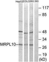 MRPL10 Antibody - Western blot analysis of extracts from HepG2 cells, COLO cells and 293 cells, using MRPL10 antibody.